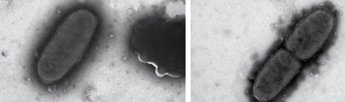 醋里面长的肥肉,醋里面长的肉