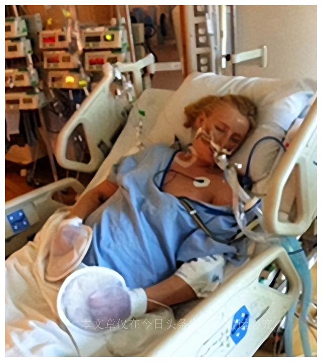 因为卫生棉条截肢的女孩,因卫生棉条截肢