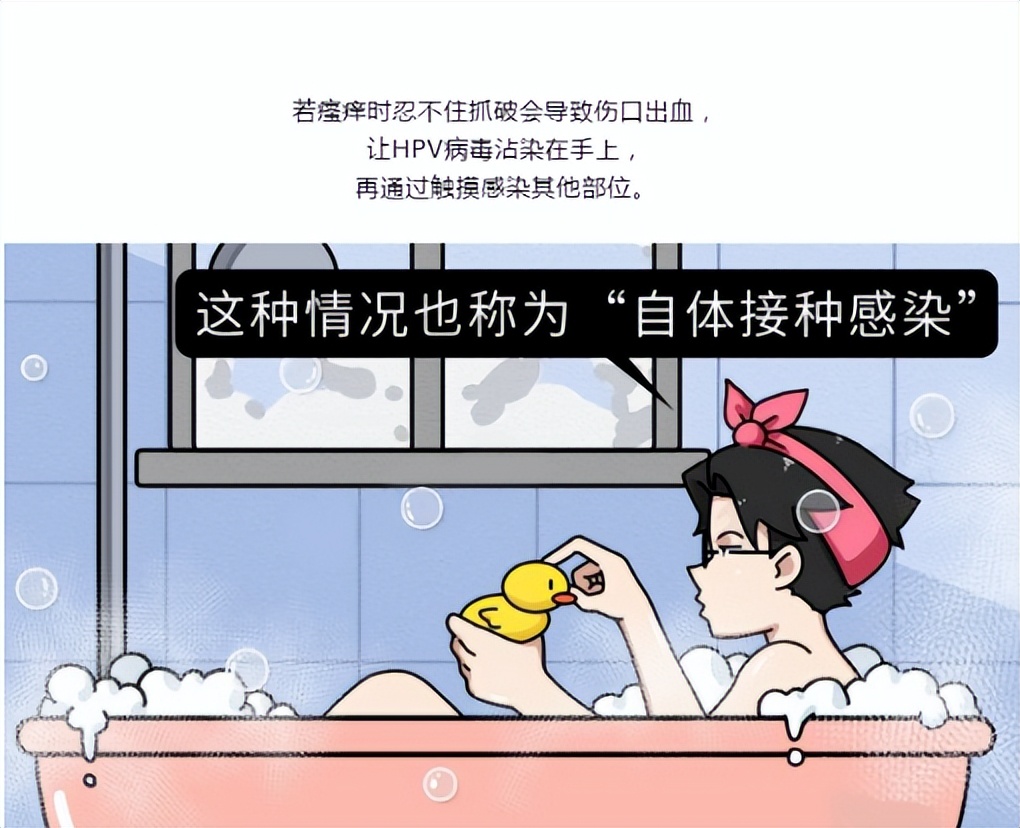 尖锐性湿疣多久不复发算康复了,尖锐性湿疣多久不复发算好了