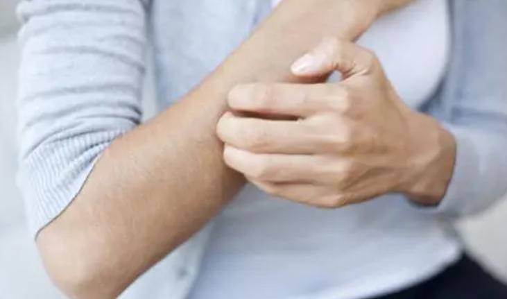 中医治湿疹止痒10大软膏,祖传秘方药膏治湿疹