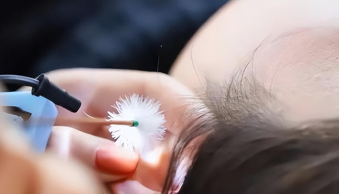 耳朵特别痒又掏不出耳屎怎么办,耳朵里痒一掏就流水是什么原因