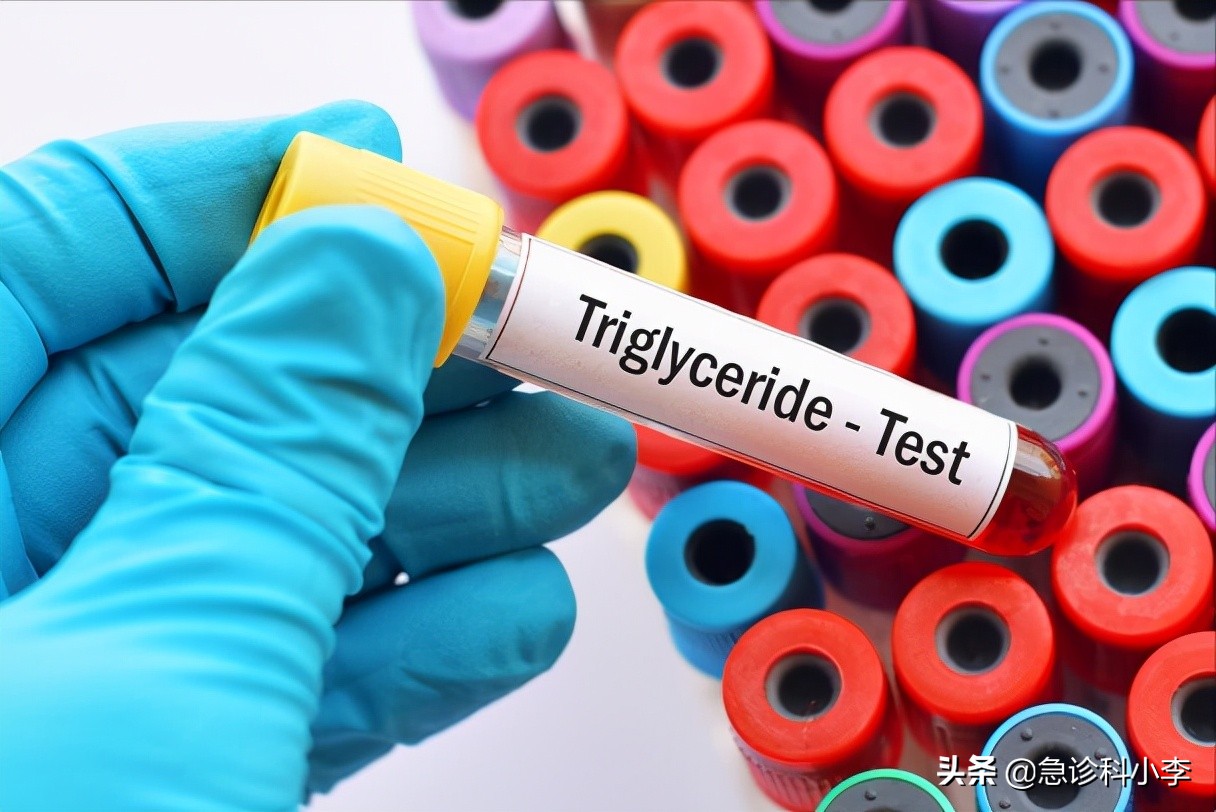 医生血脂化验单,医生一步一步教您看血脂化验单