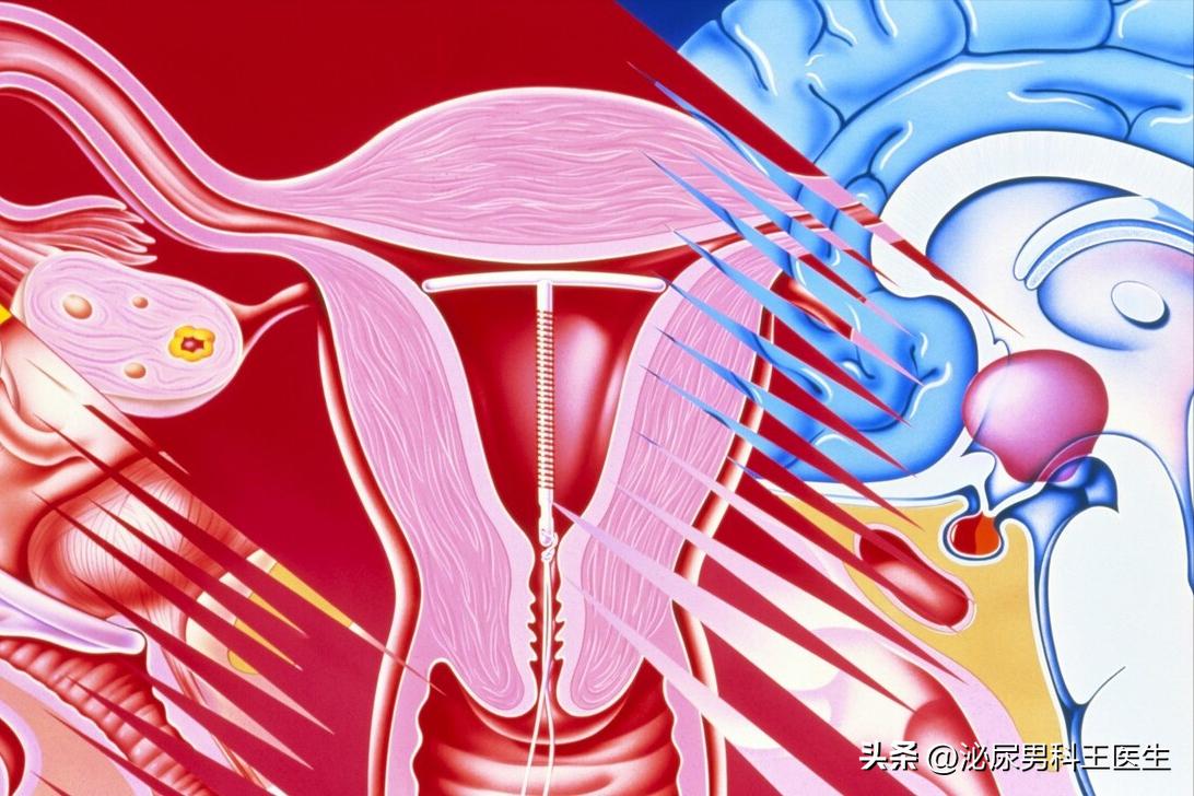 节育环一直不取绝经后出血,节育环一直不取会导致头晕吗