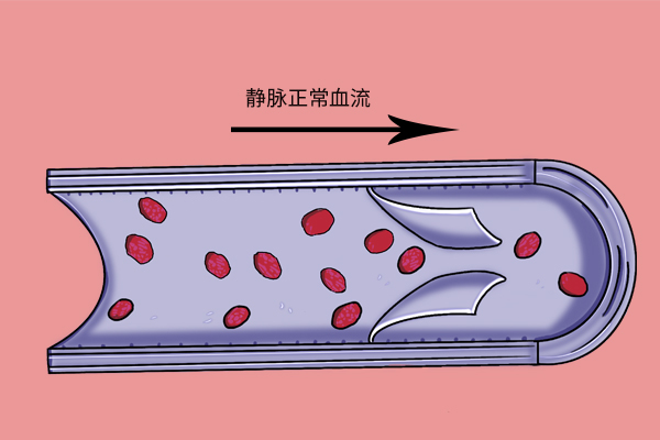 男子抠鼻子感染脑部脸肿成奥特曼,5岁男孩抠鼻子变成奥特曼脸