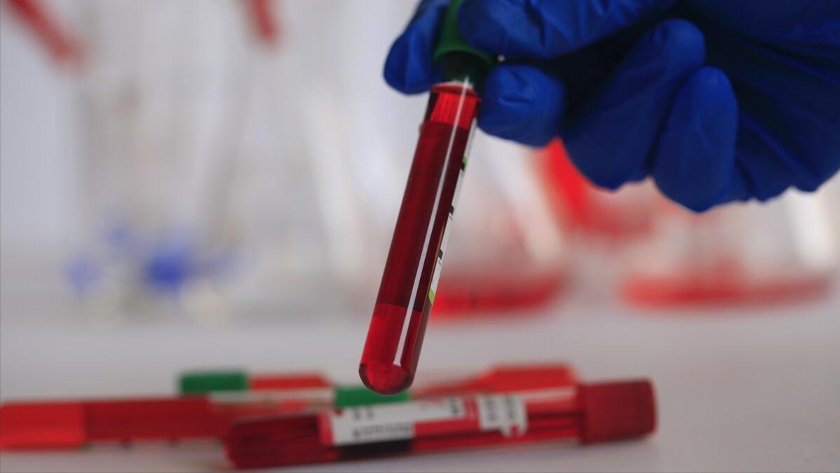 宝宝出生三天了面色发黄,新生儿出生三天皮肤发黄