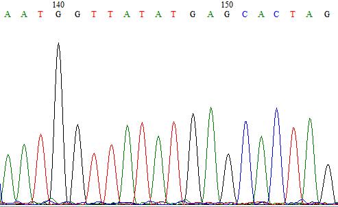 黄疸遗传代谢性疾病,遗传代谢性黄疸怎么治疗