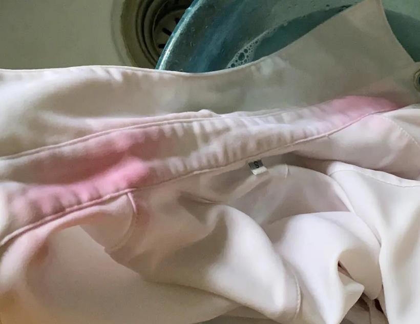 内裤老是脏黄需要换吗,内裤泛黄小妙招