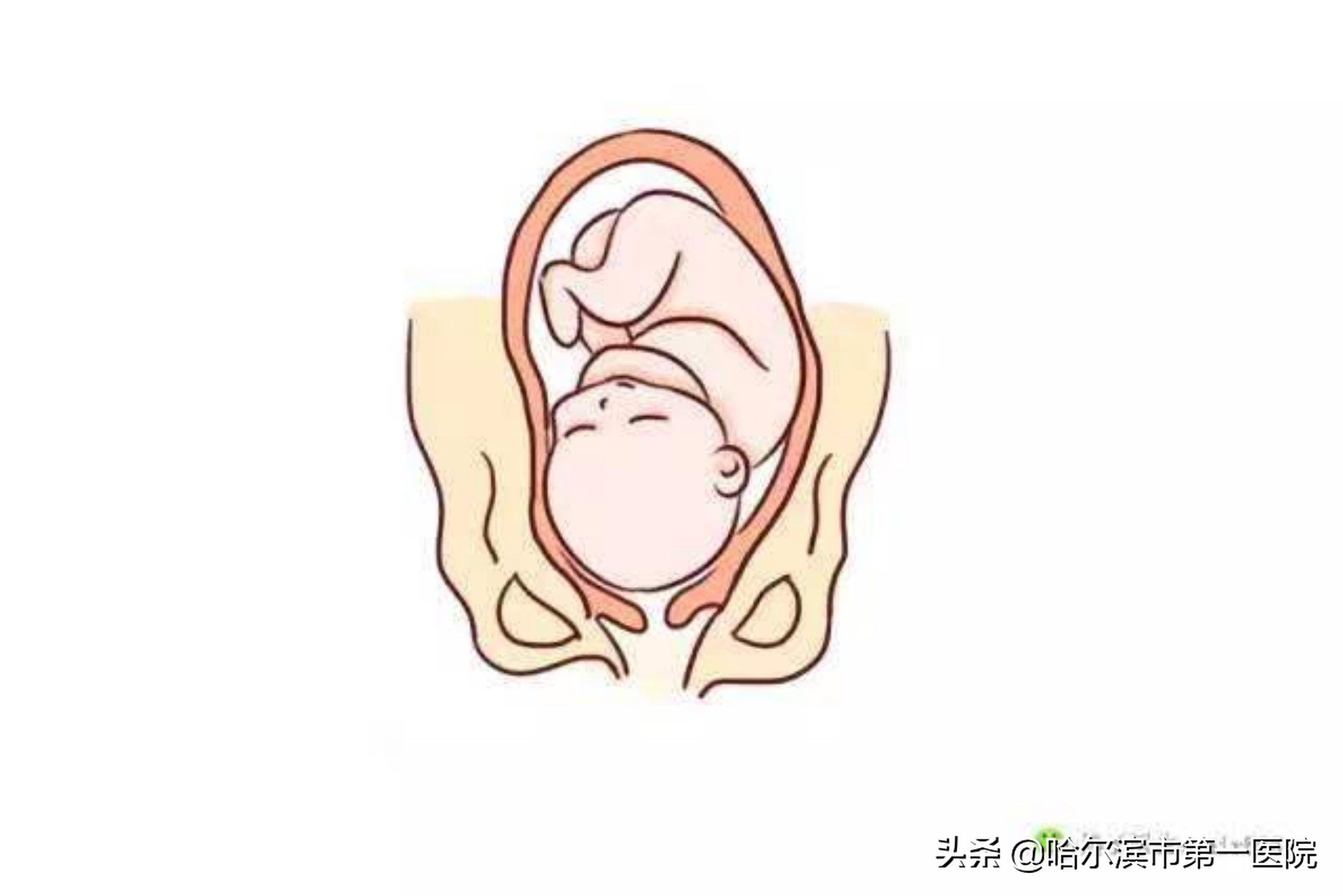 母亲节到了,宝妈们准备好了吗?哈尔滨市第一医院产一科专家与您分享:促进自然分娩,成就母子情深