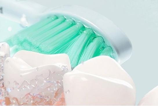 牙医推荐电动牙刷,牙医为什么建议用电动牙刷