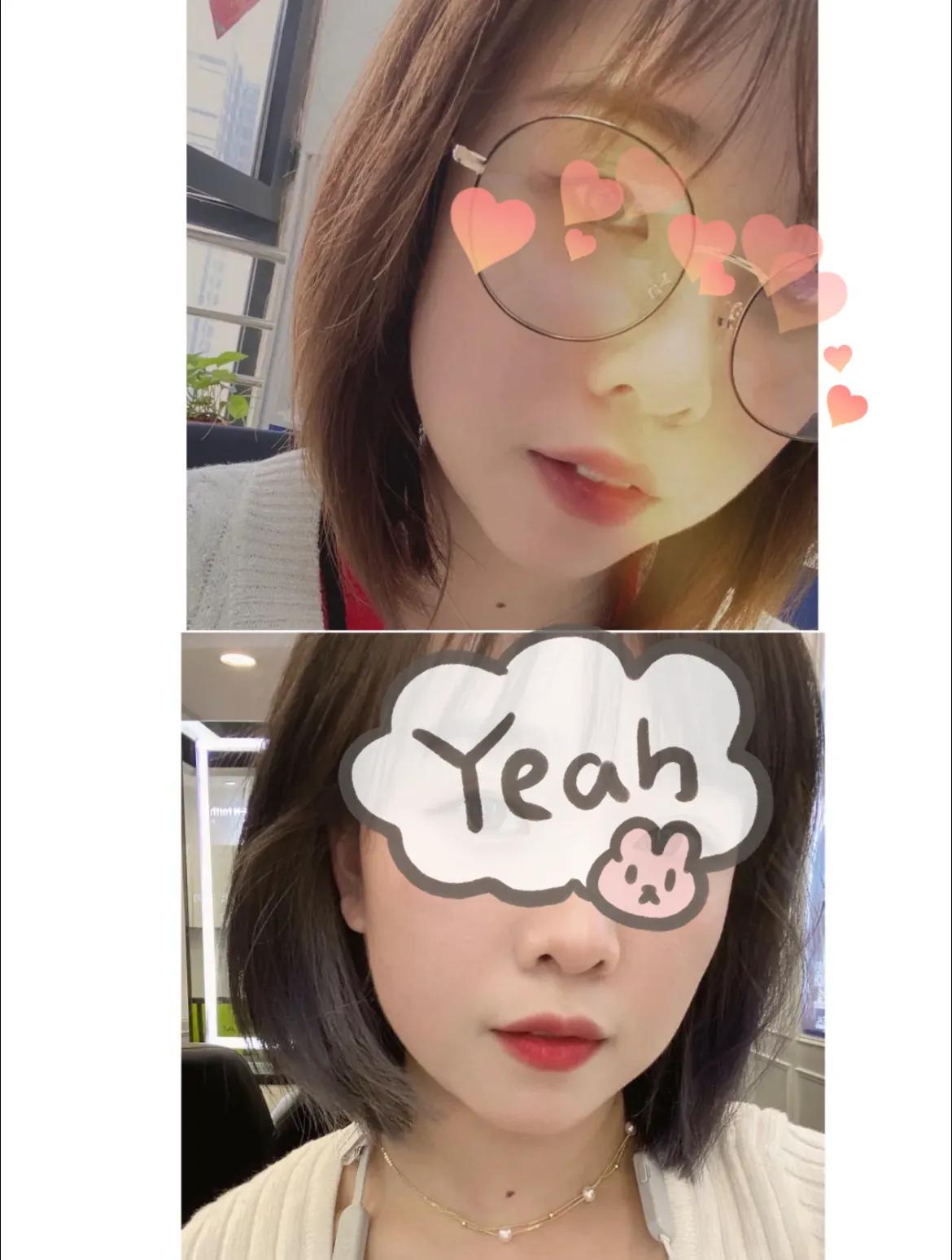 隐适美牙齿矫正有多暴利,北京牙齿矫正隐适美