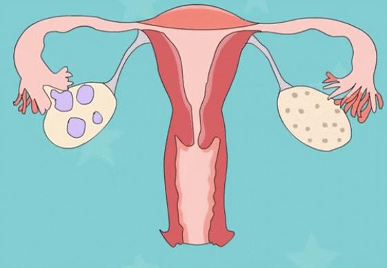 月经刚走时别急着做4件事,月经即将离开有什么症状