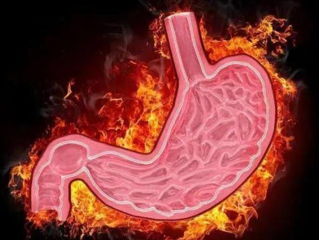 有肝火入睡难,如何判断胃火还是肝火导致失眠