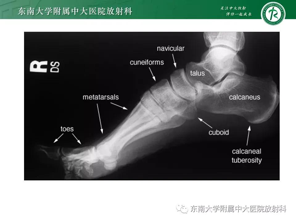 好文分享-《肌骨系统疾病——副舟骨综合征》