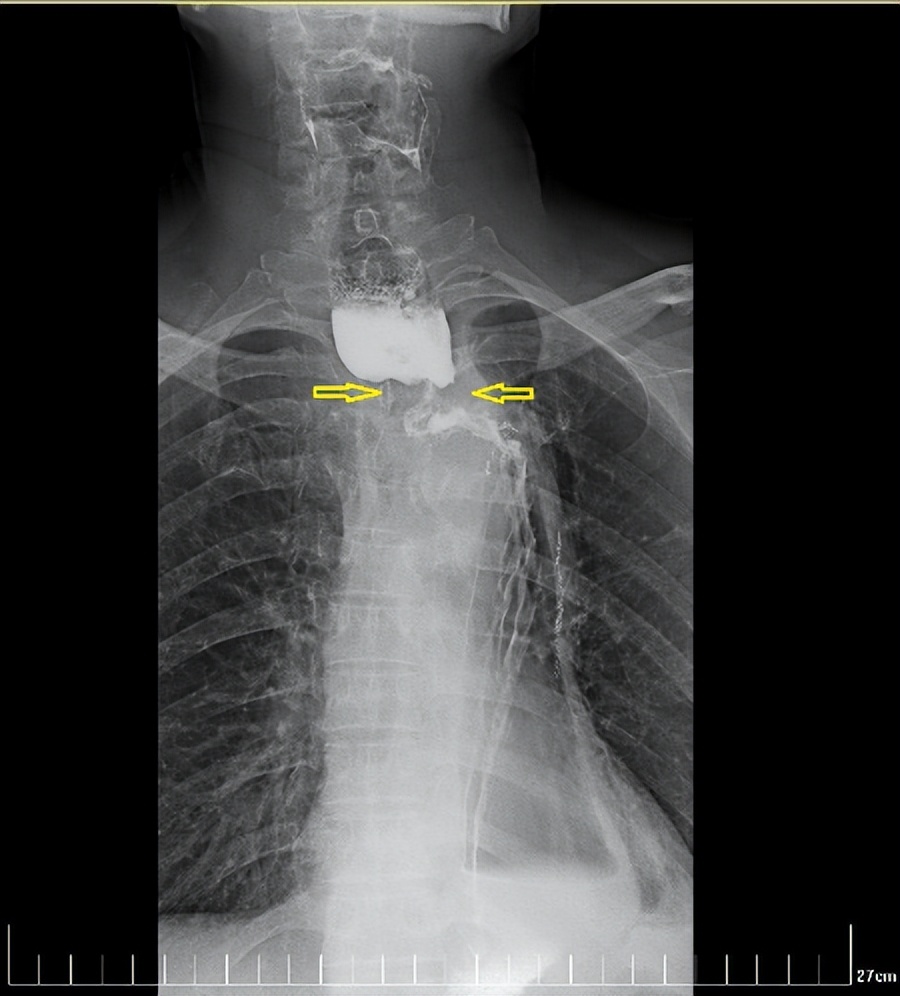 西安国际医学中心磁波刀,西安市国际医学中心肿瘤手术