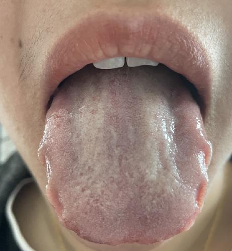 中医推荐4个补阳气调理法,一个方子解决阳气虚弱