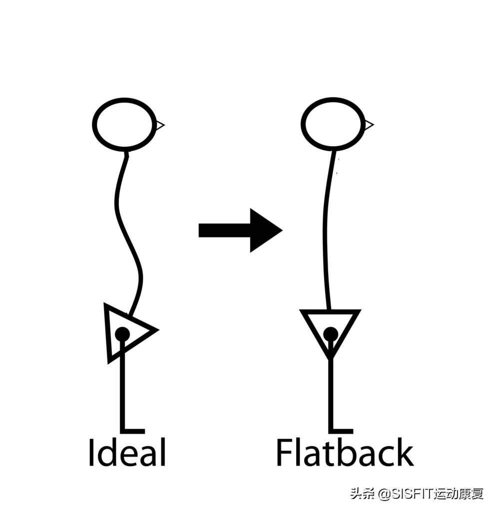 腰椎生理曲度变直可以热敷吗,腰椎生理曲度变直是怎么回事