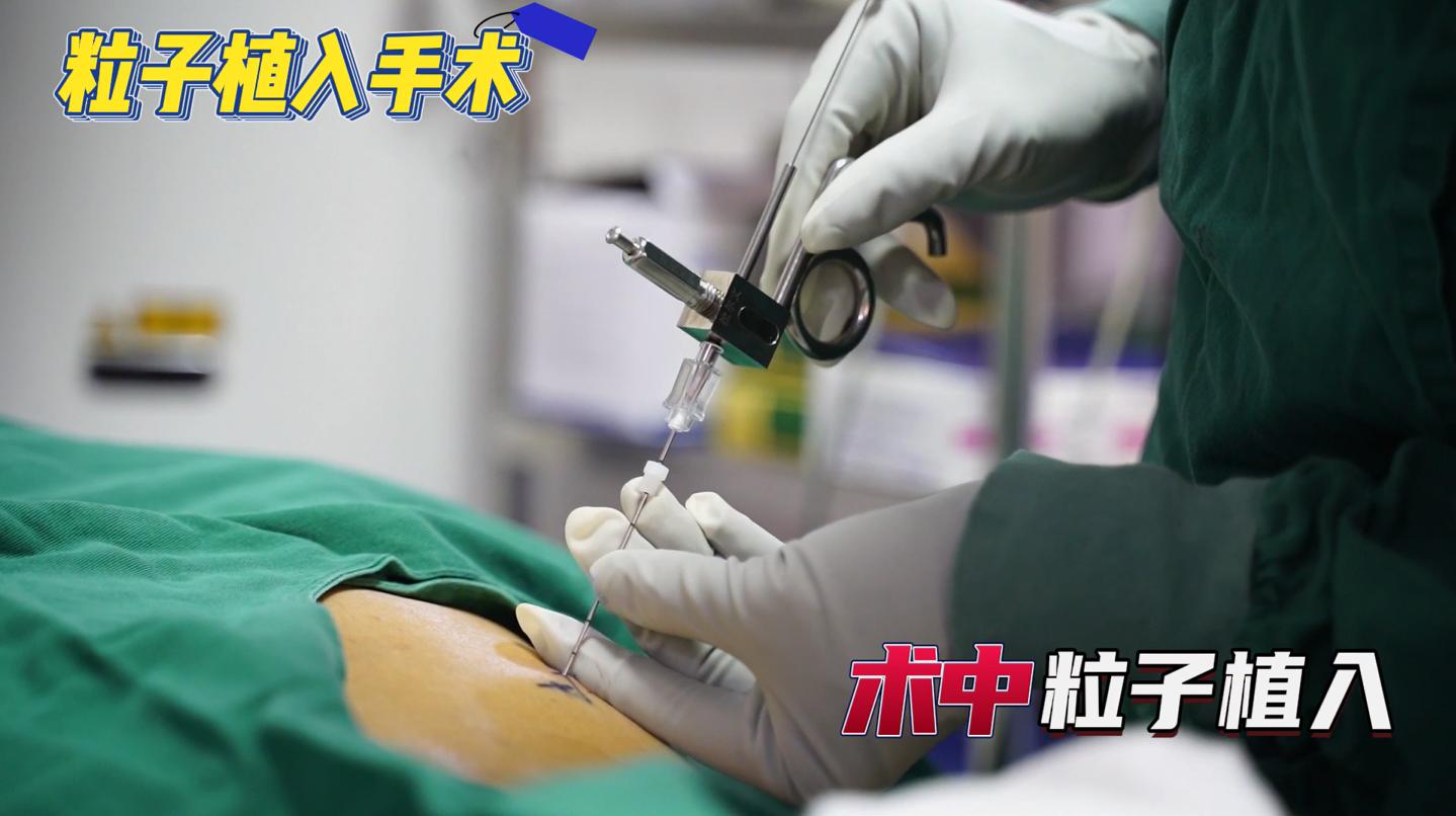 碘125粒子植入全过程展示：一根针将粒子送至肿瘤内部，精准杀癌
