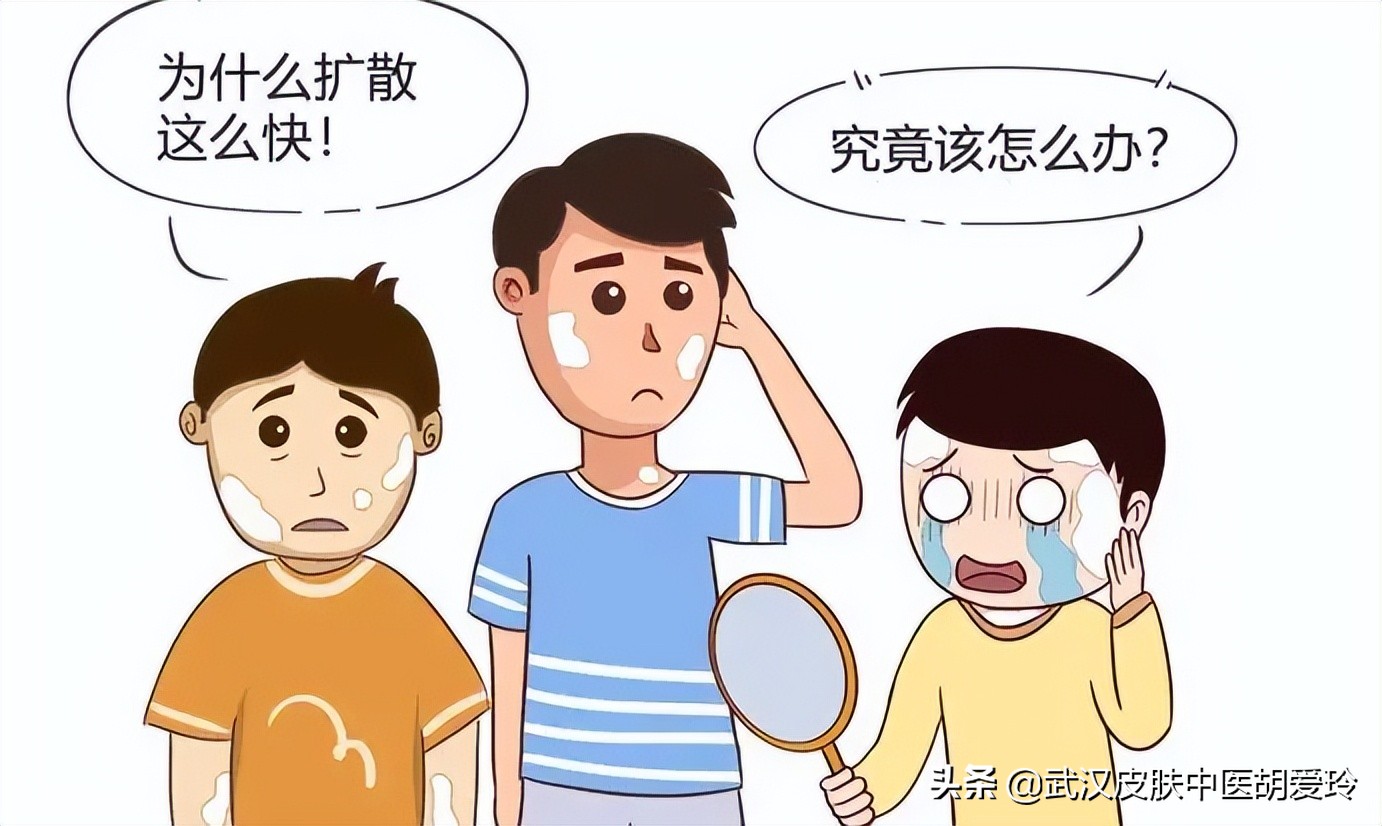 两边嘴角的嘴唇内侧有白斑和淤青,嘴角嘴唇上有小白斑吃什么药