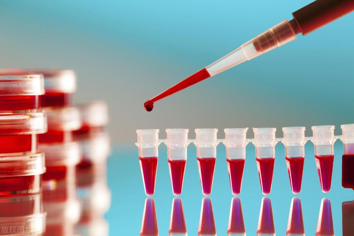 女性绝经后还轻微出血,女性绝经了发现出血