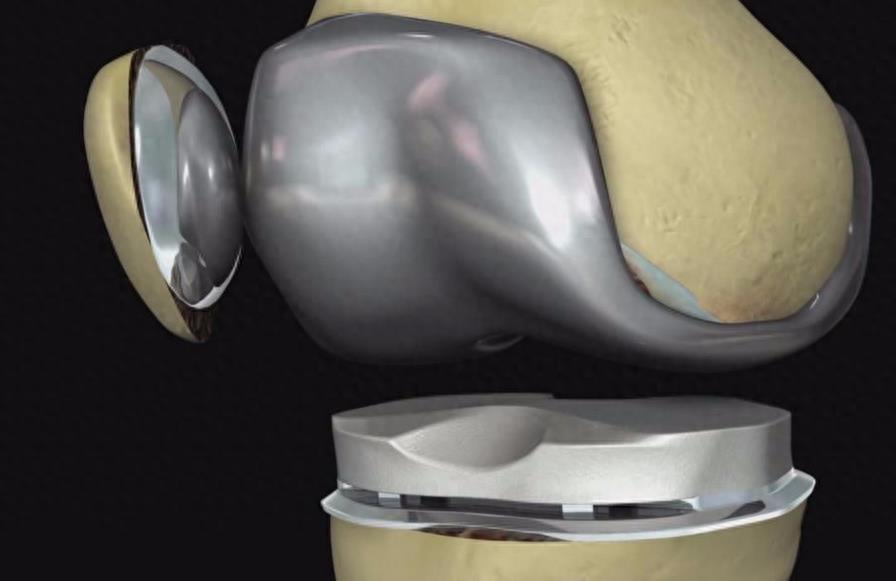 痛苦的手术排名,十大最痛苦的手术排名