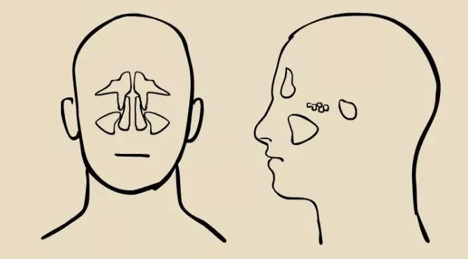 鼻窦发炎眼睛会持续疼还是偶尔疼,为什么得了鼻窦炎头很疼