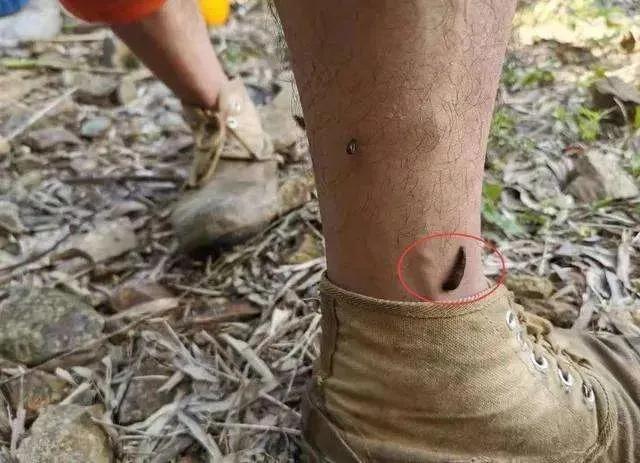 如果水蛭接触到沙子会怎么样,如果水蛭钻人血管会怎样