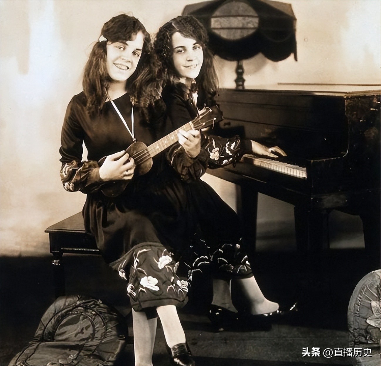 臀部连体姐妹：各有一名丈夫，姐姐死后，妹妹与遗体共存2天去世