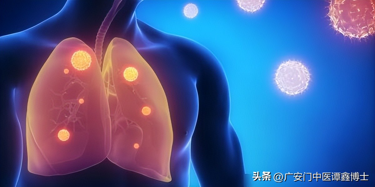 肺部肿瘤增大快属于什么类型肺癌,肺部肿瘤和肺癌的区别和危害