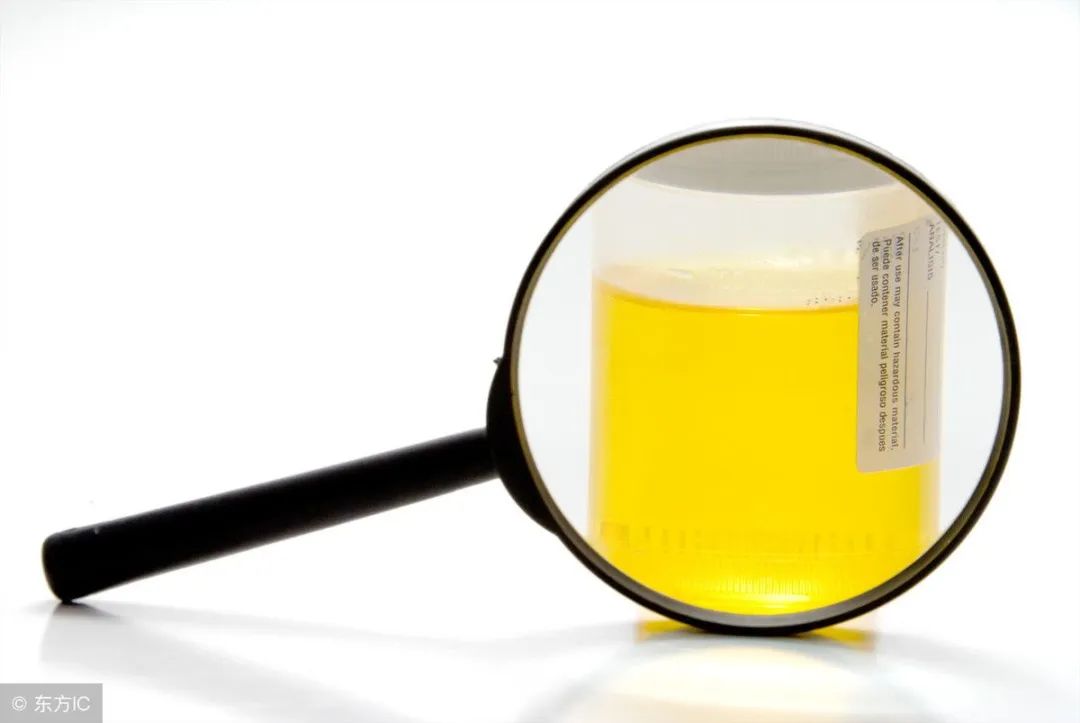 门医科普|检验科普小知识之“尿液”知多少