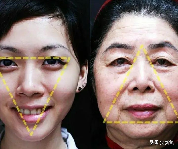 牙齿正畸和骨骼正畸的区别,牙齿正畸和眼轴增长有关系吗