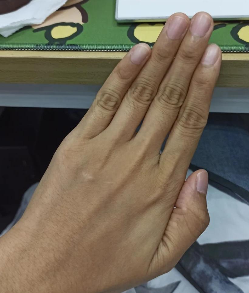 手又黑又丑什么办法能变白,怎么样才能让你的手变白白的