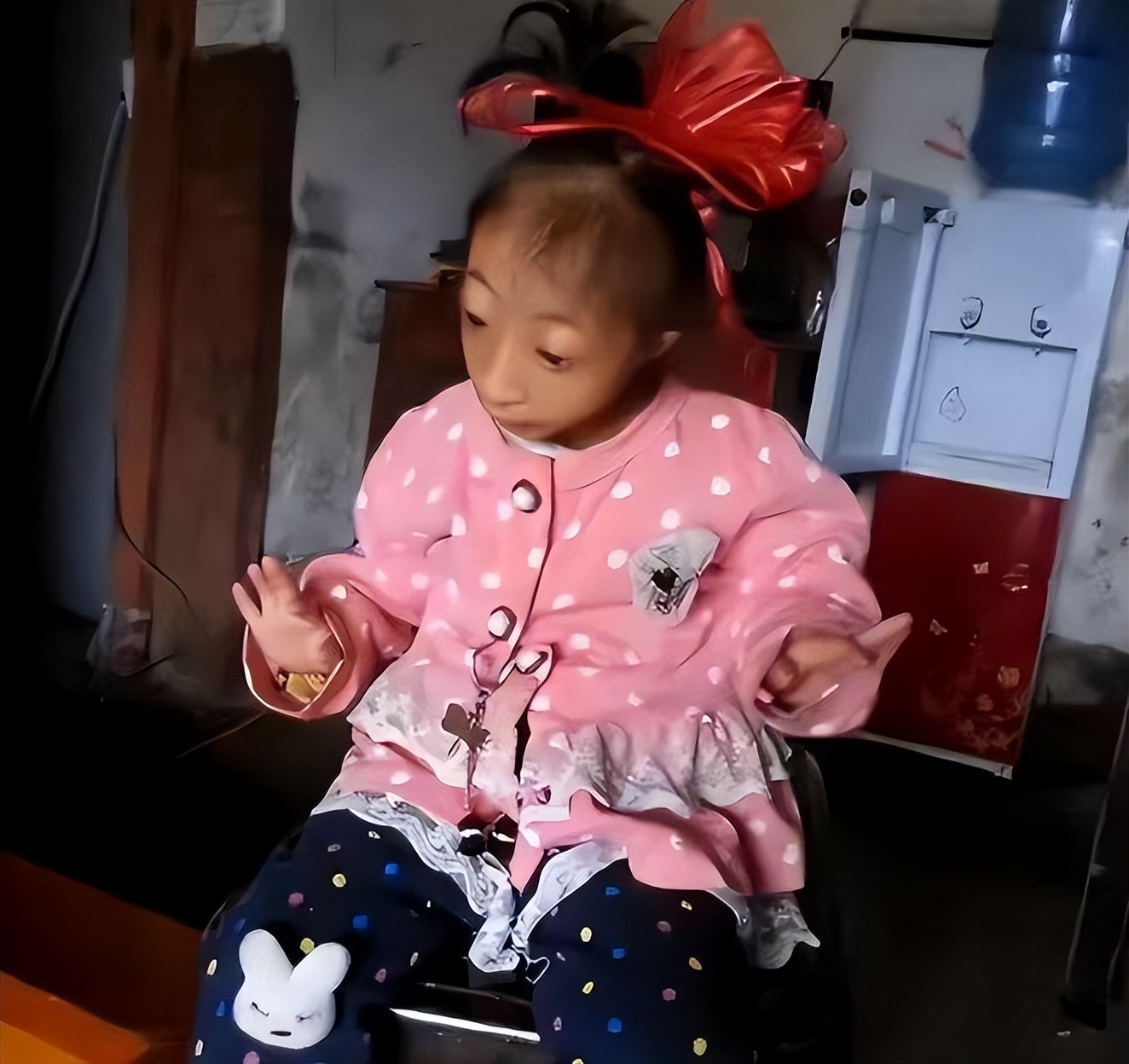 湖南生下小猴子卖给马戏团,湖南一产妇生下“小猴子”