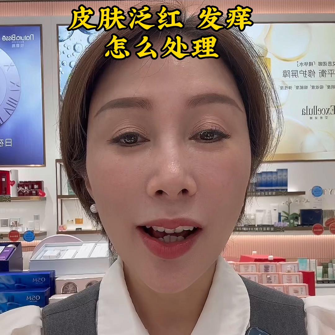 皮肤泛红发痒怎么办,儿童春季皮肤过敏泛红发痒小妙招