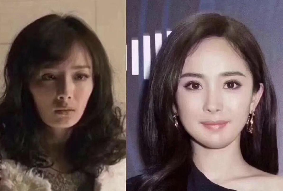 哪些明星整容后遗症越来越严重,整容明星后遗症对比图片