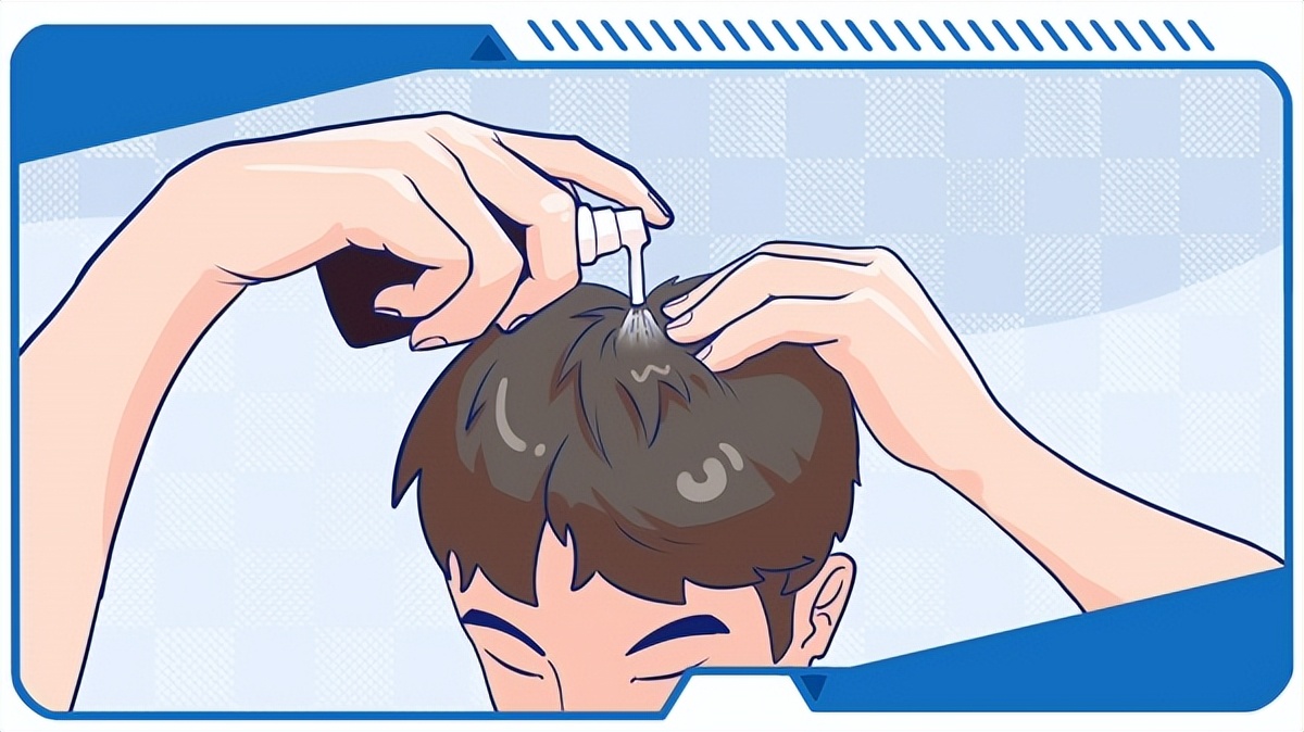 米诺地尔生发产品实测 (米诺地尔为什么叫生发神器)