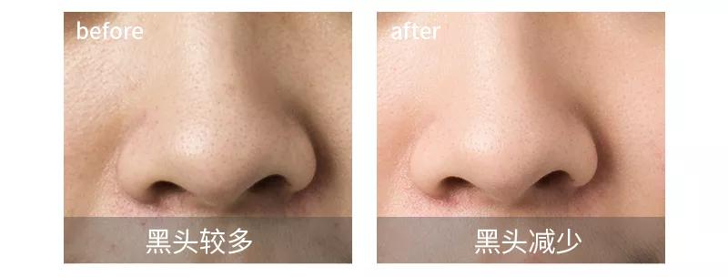 泥膜用多了屏障受损,护肤品推荐泥膜