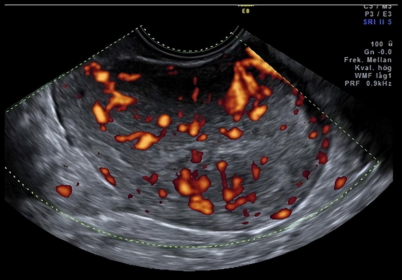 备孕期间药物导致的畸形概率,备孕期间拒绝乱用药怎么办