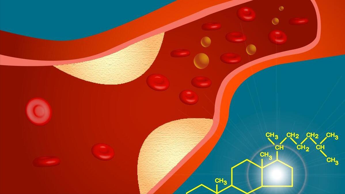 进口他汀和国产他汀有什么区别,进口他汀与国产他汀交换吃行吗