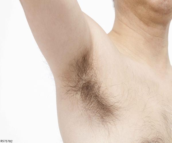 人体的毛发可以完全去掉吗,人体毛发应该怎么处理