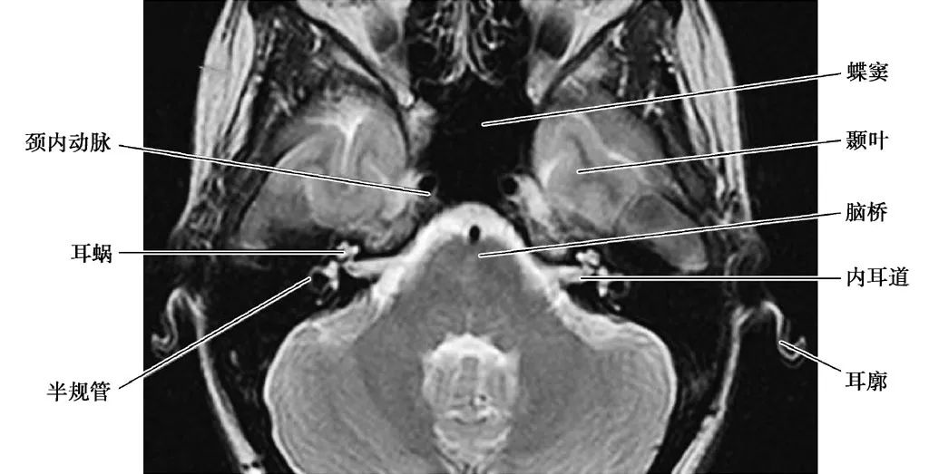 耳部解剖结构和生理功能,耳部解剖笔记