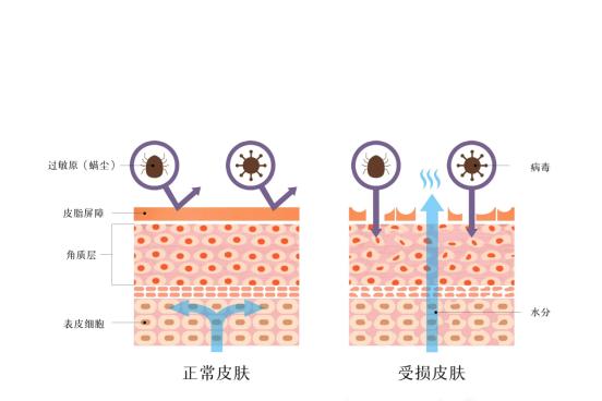 为什么皮肤会刺痛分享,皮肤为什么用什么都刺痛