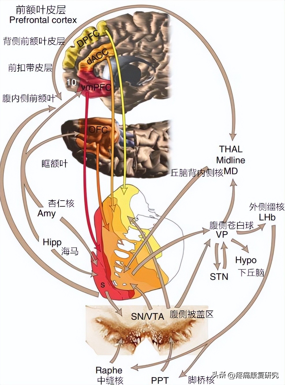 针灸止痛的原理图,针灸镇痛已被国际公认