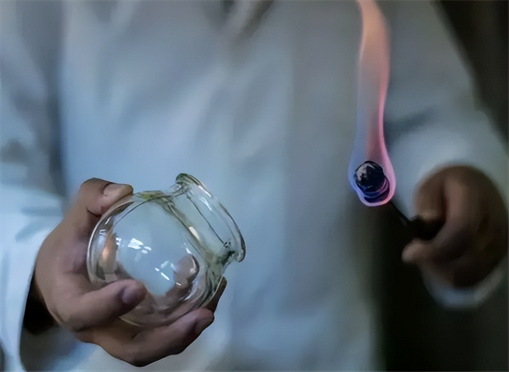 男人去拔罐对身体有好处吗,男性拔罐可以祛湿气吗