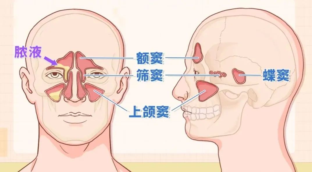 女子牙疼一周,女子牙痛用止痛药