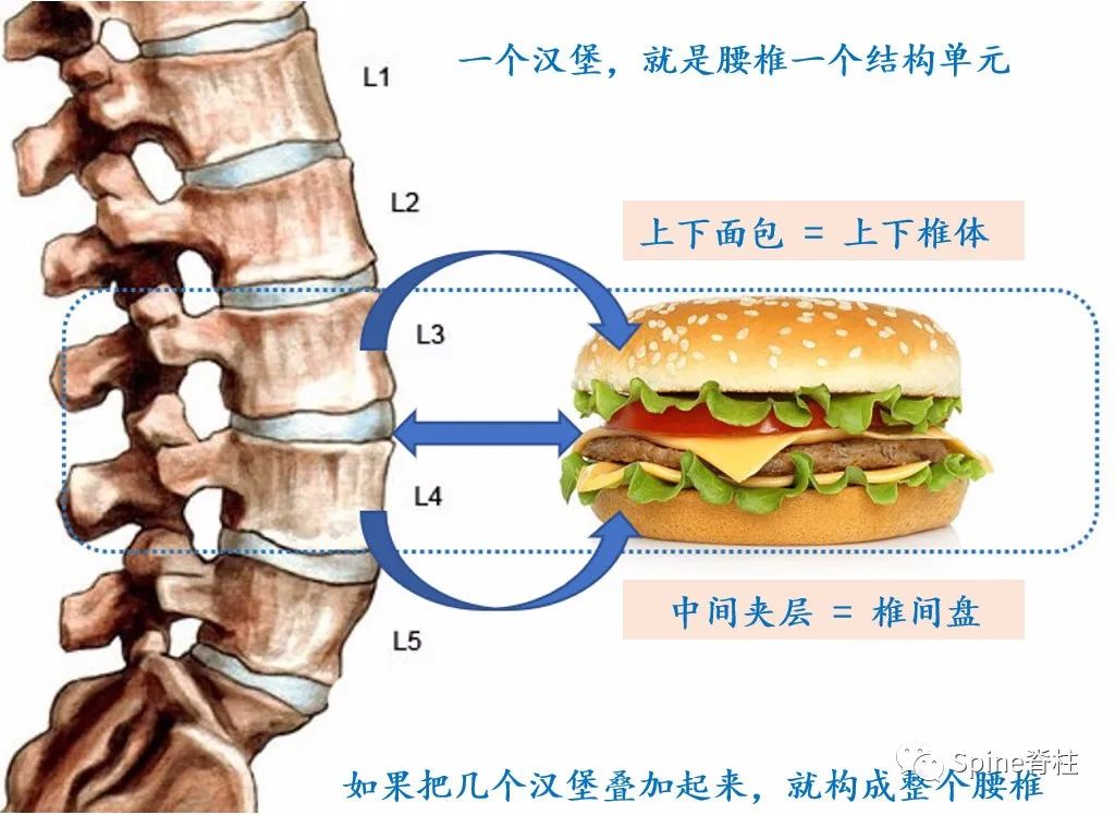 腰椎间盘突出症状表现,腰椎间盘突出症疼痛最佳止痛方法