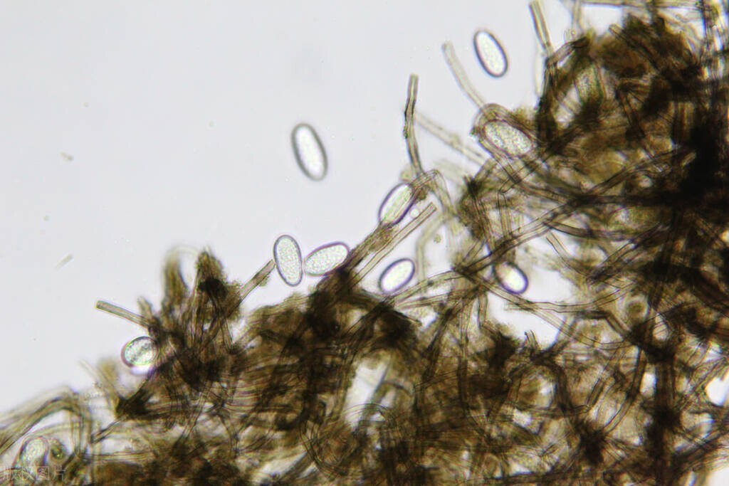 中国真菌检测试剂公司,真菌行业