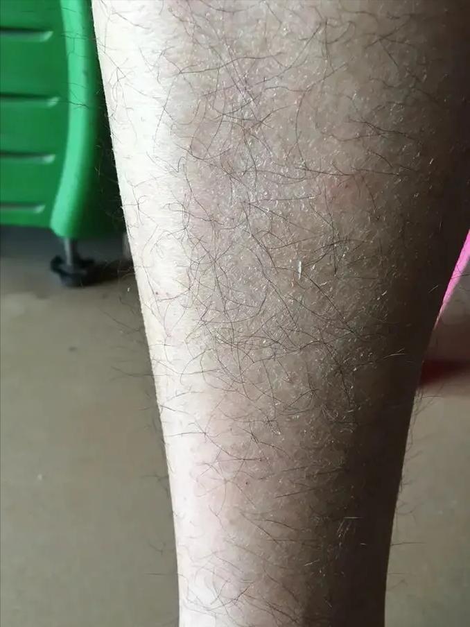 空调房待久了干燥,空调房呆久了皮肤干燥怎么办