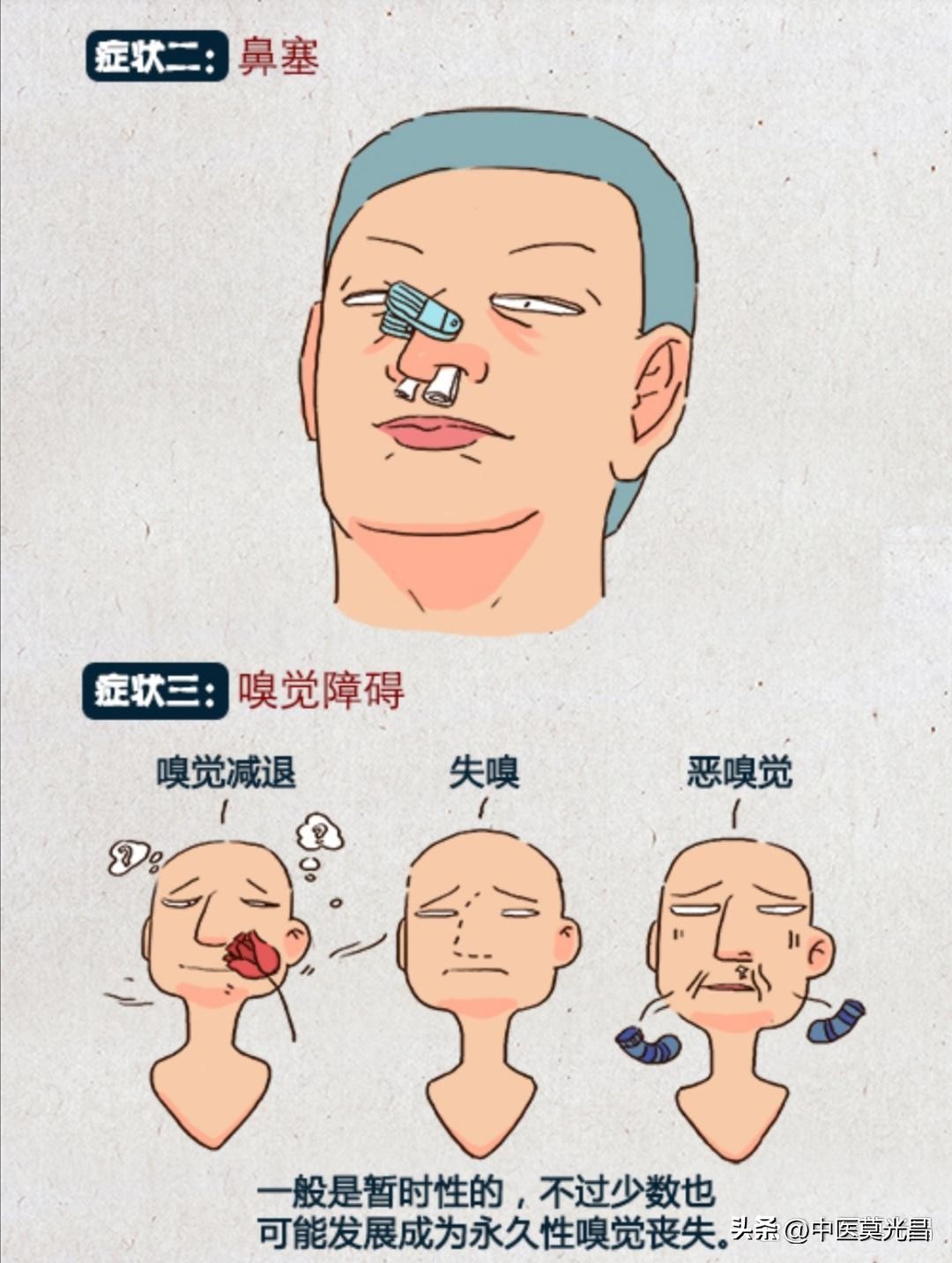 介绍一下西医关于鼻炎的治疗方案,慢性鼻炎怎么用中医治好