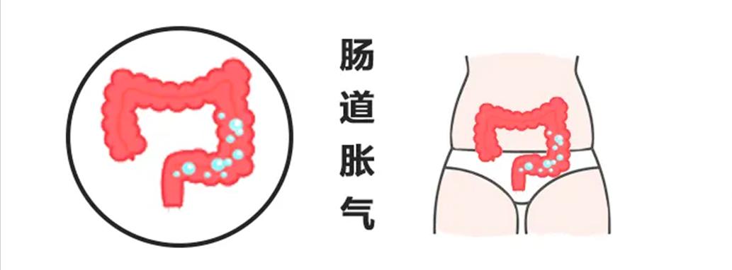 教你2招快速缓解胀气,怎样快速解除胃肠胀气