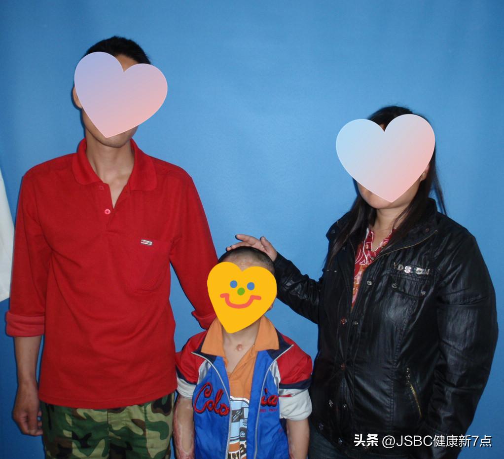 时隔13年后，拨通了手术医生的电话，严重烧伤患者“重燃”生命希望